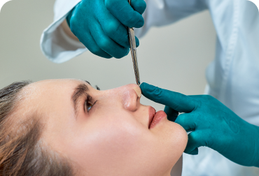 Rinoplastia