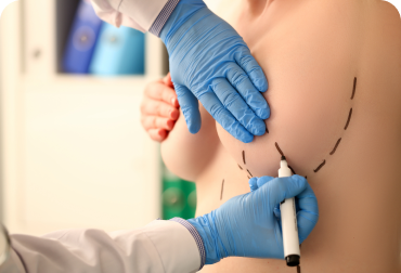 Mamoplastia
